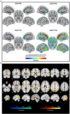 PASSED: Brain atrophy in non-demented individuals in a long-term longitudinal study from two independent cohorts